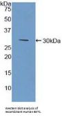 Cyclic ADP-Ribose Hydrolase 2 (BST1) Antibody
