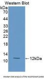 Cholesteryl Ester Transfer Protein (CETP) Antibody