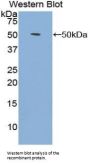 Fibroblast Growth Factor 1, Acidic / AFGF (FGF1) Antibody