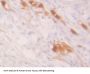 Glutathione S Transferase Alpha 2 (GSTa2) Antibody