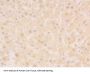 Glutathione S Transferase Alpha 2 (GSTa2) Antibody