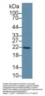 Glutathione S Transferase Kappa 1 (GSTk1) Antibody