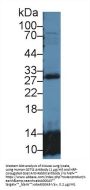 Glutathione S Transferase Theta 2 (GSTt2) Antibody