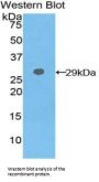 Glutathione S Transferase Theta 2 (GSTt2) Antibody