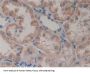 Glutathione S Transferase Theta 2 (GSTt2) Antibody