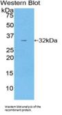 Heat Shock Protein 90 kDa Beta 1 (HSP90B1) Antibody