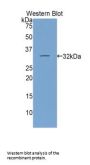 Inter Alpha-Globulin Inhibitor H1 (ITIH1) Antibody
