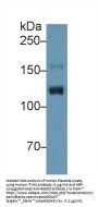 Inter Alpha-Globulin Inhibitor H4 (ITIH4) Antibody
