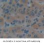Inter Alpha-Globulin Inhibitor H4 (ITIH4) Antibody