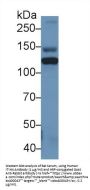 Inter Alpha-Globulin Inhibitor H4 (ITIH4) Antibody