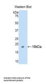 Inter Alpha-Globulin Inhibitor H4 (ITIH4) Antibody