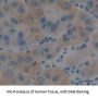 Inter Alpha-Globulin Inhibitor H4 (ITIH4) Antibody