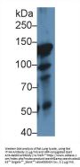 Inter Alpha-Globulin Inhibitor H4 (ITIH4) Antibody