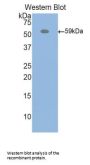 Inter Alpha-Globulin Inhibitor H4 (ITIH4) Antibody