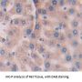 Inter Alpha-Globulin Inhibitor H4 (ITIH4) Antibody