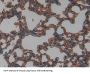 Intercellular Adhesion Molecule 1 (ICAM1) Antibody