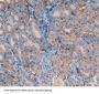 Intercellular Adhesion Molecule 1 (ICAM1) Antibody