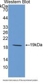 Interleukin 1 Receptor Antagonist (IL1RN) Antibody