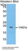 Interleukin 1 Receptor Antagonist (IL1RN) Antibody