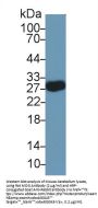 Myelin Oligodendrocyte Glycoprotein (MOG) Antibody