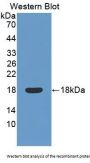 Myelin Oligodendrocyte Glycoprotein (MOG) Antibody