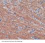 Myelin Oligodendrocyte Glycoprotein (MOG) Antibody