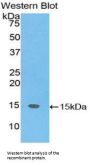 SH2 Domain Containing Protein 1A (SH2D1A) Antibody