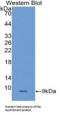 Squamous Cell Carcinoma Antigen 2 (SCCA2) Antibody