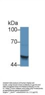 Squamous Cell Carcinoma Antigen 2 (SCCA2) Antibody