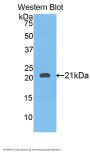 Squamous Cell Carcinoma Antigen 2 (SCCA2) Antibody