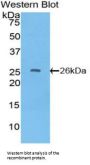 Tissue Factor Pathway Inhibitor 2 (TFPI2) Antibody