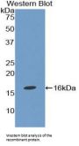 TGFb1 Antibody