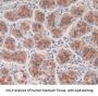 Transforming Growth Factor Beta 3 (TGFb3) Antibody