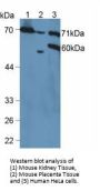 Vascular Cell Adhesion Molecule 1 (VCAM1) Antibody