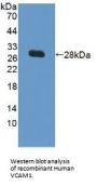 Vascular Cell Adhesion Molecule 1 (VCAM1) Antibody