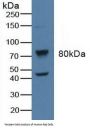 Adrenergic Receptor Beta Kinase 1 (ADRbK1) Antibody
