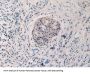 Adrenergic Receptor Beta Kinase 1 (ADRbK1) Antibody