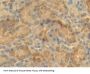 B-Cell CLL/Lymphoma 2 Like Protein (Bcl2L) Antibody