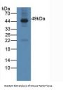 Galactose-3-O-Sulfotransferase 1 (GAL3ST1) Antibody