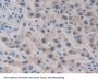 HAUS Augmin Like Complex Subunit 7 (HAUS7) Antibody