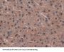 Isocitrate Dehydrogenase 1, Soluble (IDH1) Antibody