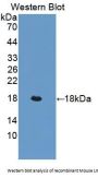 LIFR Antibody