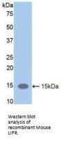 Leukemia Inhibitory Factor Receptor (LIFR) Antibody