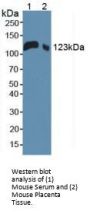 Leukemia Inhibitory Factor Receptor (LIFR) Antibody