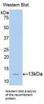 Phospholipase A2 Activating Protein (PLAA) Antibody