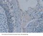 Phospholipase A2 Activating Protein (PLAA) Antibody