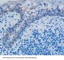 Phospholipase A2 Activating Protein (PLAA) Antibody
