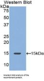 Platelet Derived Growth Factor AA (PDGFAA) Antibody