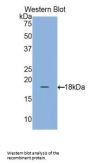 Retinol-Binding Protein 1 (RBP1) Antibody