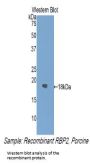 Retinol Binding Protein 2, Cellular (RBP2) Antibody